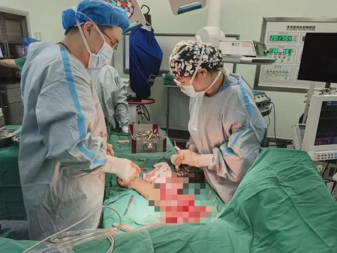 江苏一男子坐车时手伸到车窗外突遇车祸胳膊“断”成了3截仅剩几公分皮肤组织相连：“疼得钻心！”